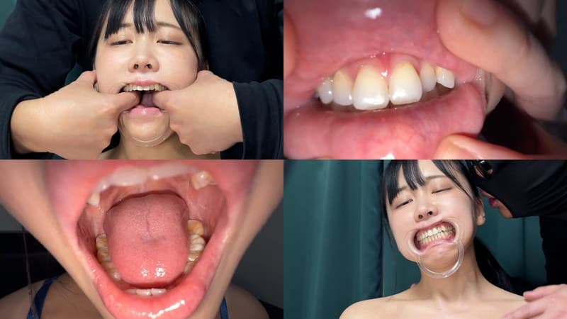 よだれダラダラすずちゃんの口内観察