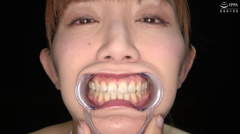 【歯・口内フェチ】綺麗なお姉さんの激レアな治療跡がある歯・口内・のどちんこ観察! 美泉咲